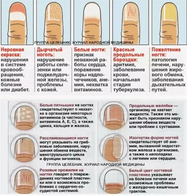 О каких заболеваниях говорят ногти на руках и ногах - Лайфхакер