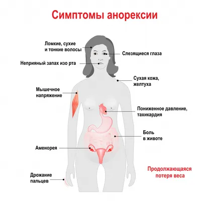 Анорексия - причины появления, симптомы заболевания, диагностика и способы  лечения