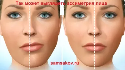 Китайская карта лица ➤ Публикация ⭐ Косметологической Клиники BeautyMED