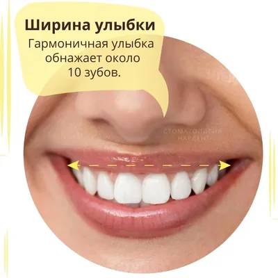 Формула идеальной улыбки — стоматология метро Каширская
