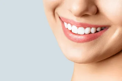 Десневая улыбка. Методы коррекции. Пример коррекции десневой улыбки  Ботоксом (Botox).