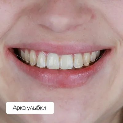 1-я заповедь красивой улыбки - АРКА УЛЫБКИ:)» — Яндекс Кью