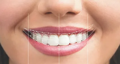 Эстетическая стоматология. 10 признаков идеальной улыбки. | Эстетическая  стоматология в Санкт-Петербурге Кирилла Костина