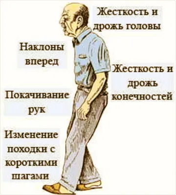 Дёргается глаз» - тревожный симптом или вариант нормы? | Здоровое тело |  Дзен