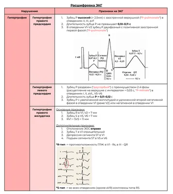 Расшифровка ЭКГ норма, таблица, параметры, элементы.