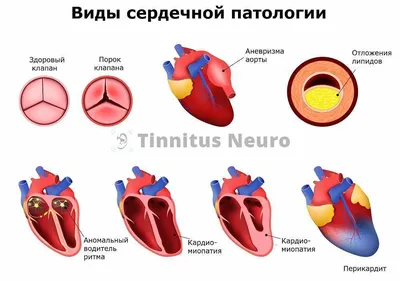 ЭКГ с расшифровкой в Москве. Анализы и расшифровка от лучших специалистов.