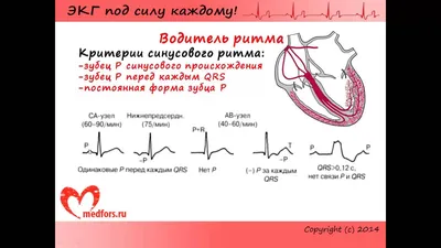 Электрокардиография (ЭКГ) - «Оказывается ЭКГ не такая уж и информативная  диагностика проблем с сердцем, но ей по прежнему верит и скорая, и  кардиологи. Но сделать ЭКГ всегда необходимо. » | отзывы