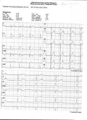 Ответы : Просьба помочь с расшифровкой ЭКГ
