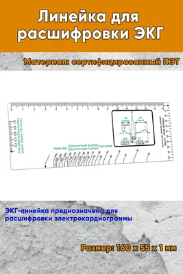 Расшифровка ЭКГ с нагрузкой | Консультация кардиолога в Минске на   - ВРАЧИ БЕЛАРУСИ