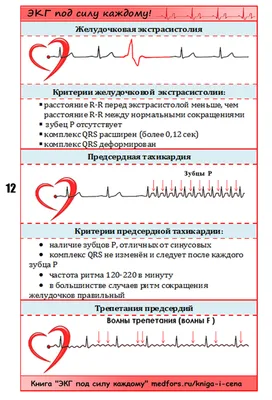 Быстрая расшифровка ЭКГ | Александр Сеченов из медицинской онлайн школы -  Sechenov Universkill | Дзен