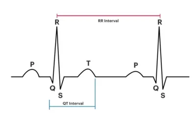 Норма ЭКГ. Все интервалы и зубцы: p, QRS, T, PR, ST - YouTube