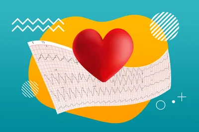 ЭКГ с расшифровкой в Севастополе - цена, записаться на электрокардиограмму  в МЦ Мята