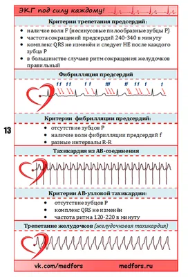 На ЭКГ блокада сердца: что это значит, простыми словами.