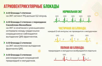 ЭКГ с расшифровкой.