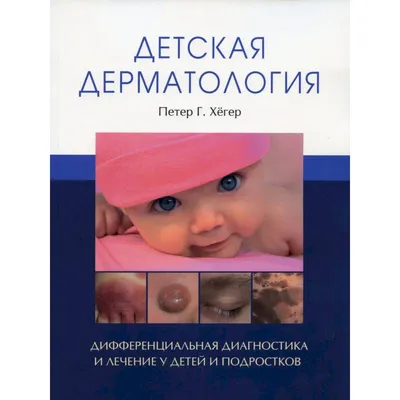 Дерматология Фицпатрика в клинической практике. Комплект 1, 2, 3, тома .  Второе издание . - Голдсмит Л.А., Кац С.И., Джилкрест Б.А., Купить c  быстрой доставкой или самовывозом, ISBN 978-5-91839-062-x - КомБук  ()