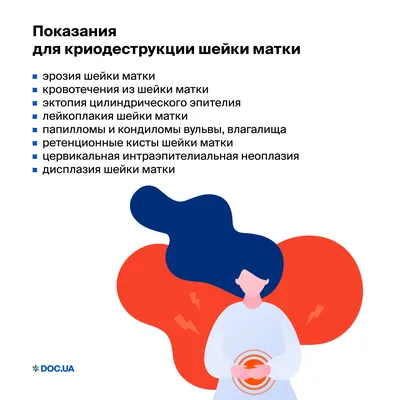Лазерное лечение эрозии шейки матки Киев | Цены 2022 | Дисплазии