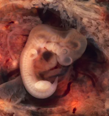 Стадии развития эмбриона, набор из 9 моделей – Avikontex