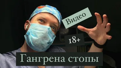 Незаживающие раны при синдроме диабетической стопы - Prof. Dr. Özgür  Kılıçkesmez