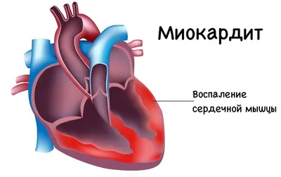 Как болит сердце на самом деле? | Здоровье вашего организма | Дзен