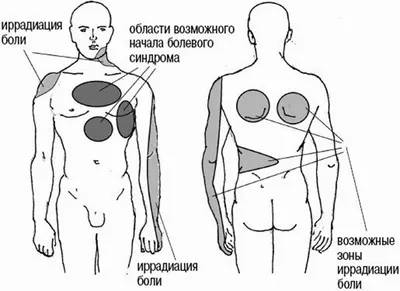 Боли в области сердца