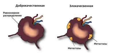 Лечение тянущей боли в колене - Свобода Движения