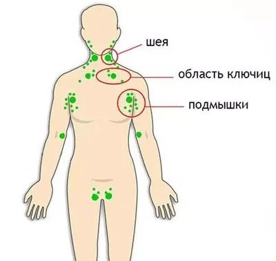 Опасный симптом: если вы заметили увеличение лимфоузлов под мышками, срочно  обратитесь к врачу |  | Дзен