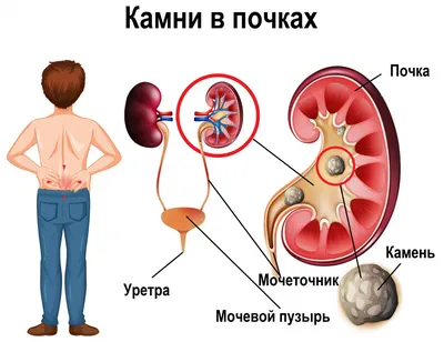 Где находится селезенка у человека и как она болит, симптомы у женщин и  мужчин.