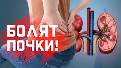 Врач пояснила - как болят почки: 12 ключевых симптомов, которые нельзя  перепутать | О здоровье: с медицинского на русский | Дзен