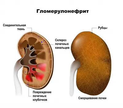 Sina (Китай): пять признаков, что у вас не в порядке почки! (,  Китай) | , ИноСМИ