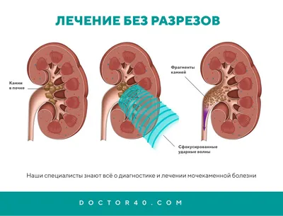 Центр эндоурологии и литотрипсии в Обнинске - «Доктор Плюс»