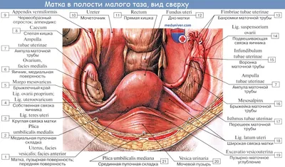 Застудила придатки: сальпингоофорит - что это такое у женщин, симптомы,  лечение