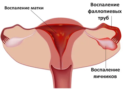 Боль в правом боку под ребрами у ребенка – почему возникает этот симптом |  Мир мам: блог педиатра | Дзен