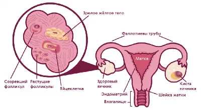 Анатомия: Маточная труба. Строение стенки трубы. Придаток яичника и  околояичник