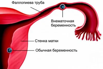 Как понять, что болят яичники — блог медицинского центра ОН Клиник