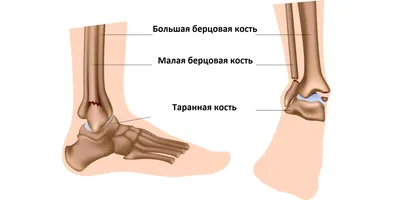 ФУНКЦИОНАЛЬНАЯ АНАТОМИЯ МЫШЕЧНОЙ СИСТЕМЫ | ОТВОДЯЩИЕ БЕДРО | Библиотека  тренера