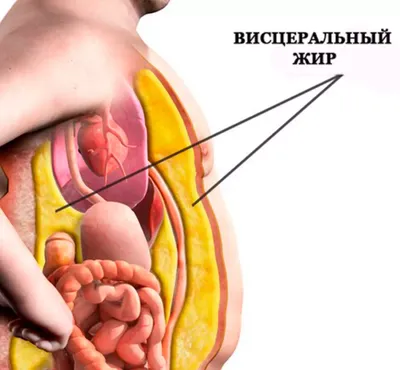 Перикардит сердца - симптомы, что это, клинические рекомендации, лечение