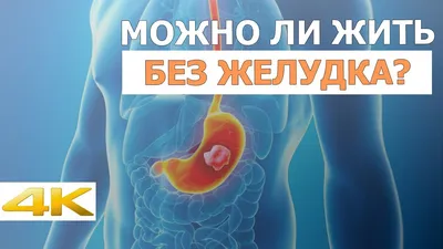 Почему капсульная эндоскопия не заменяет гастроскопию и колоноскопию? |  Клиническая больница №122 имени Л.Г.Соколова Федерального  Медико-Биологического Агентства