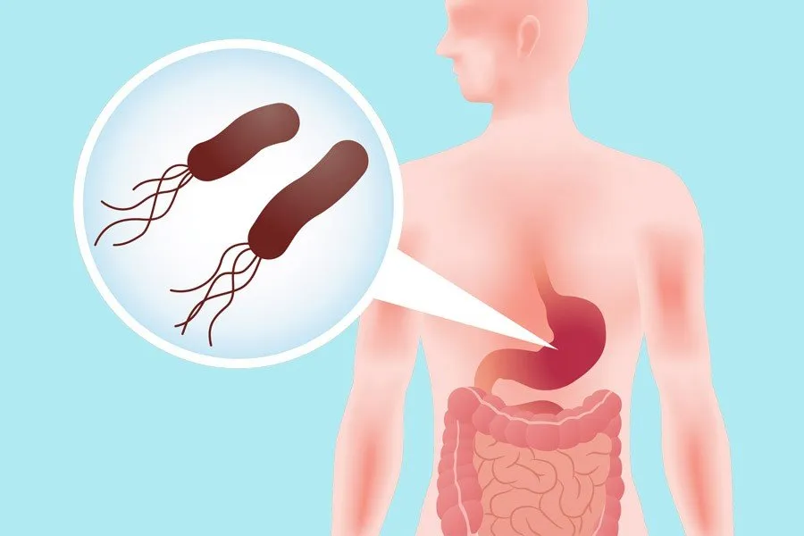 Причины появления бактерий в желудке