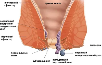 NATUROTEKA Обезболивающий крем от геморроя, заживляющий от трещин