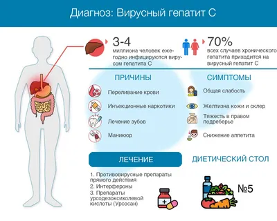 Гепатит С: причины появления, классификация, симптомы, диагностика и  способы лечения,