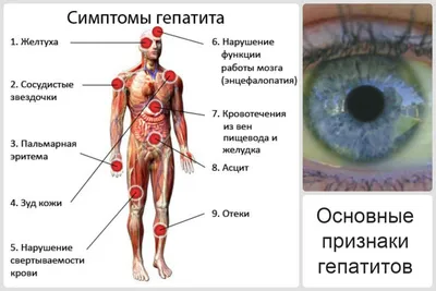 Гепатит С. Лечение гепатита С. Как можно заразиться гепатитом С.