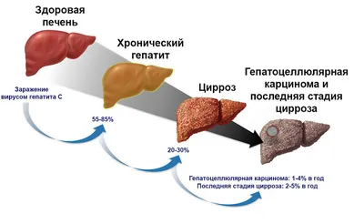 Глазуновская ЦРБ : Вирус гепатит С