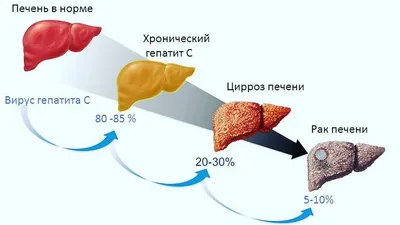 Гепатит с 58 картинок