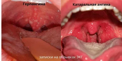 Мы Вас слышим, а Вы нас | Записки на обрывках ЭКГ | Дзен