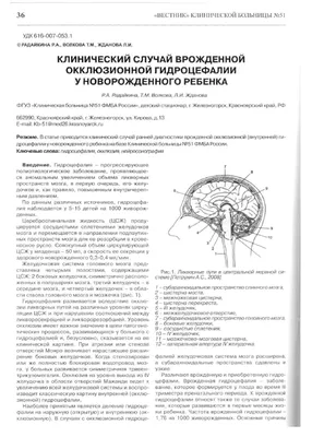 Клинический случай врожденной окклюзионной гидроцефалии у новорожденного  ребенка – тема научной статьи по клинической медицине читайте бесплатно  текст научно-исследовательской работы в электронной библиотеке КиберЛенинка