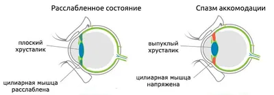 Гимнастика для глаз при близорукости – упражнения, ЛФК, массаж при миопии