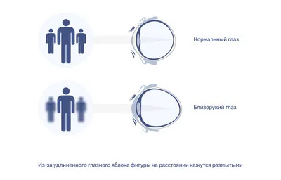 Гимнастика для глаз. Лучшие упражнения для улучшения и восстановления  зрения, одобренные офтальмологами