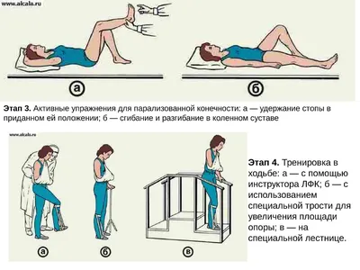 ВОССТАНОВЛЕНИЕ ДВИГАТЕЛЬНОЙ АКТИВНОСТИ ПОСЛЕ ИНСУЛЬТА | Сиделка поневоле |  Дзен