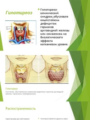 гипотиреоз презентация | PDF