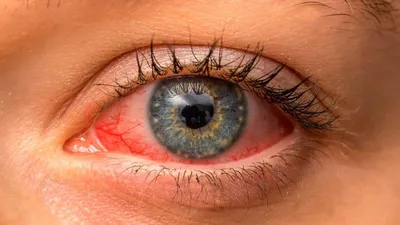Здоровье глаз детей. Как отслеживать потребность в очках? | Блог  интернет-магазина 